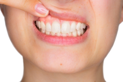 This is the image for the news article titled Healthy Gums for a Healthy Mouth